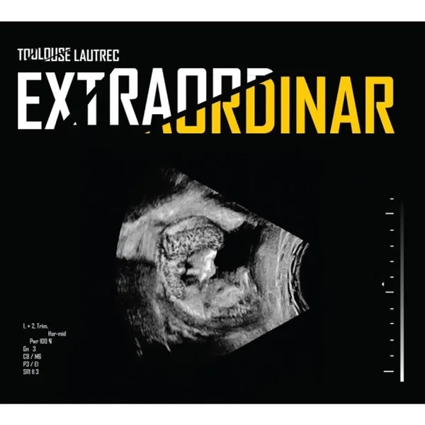 Extraordinar