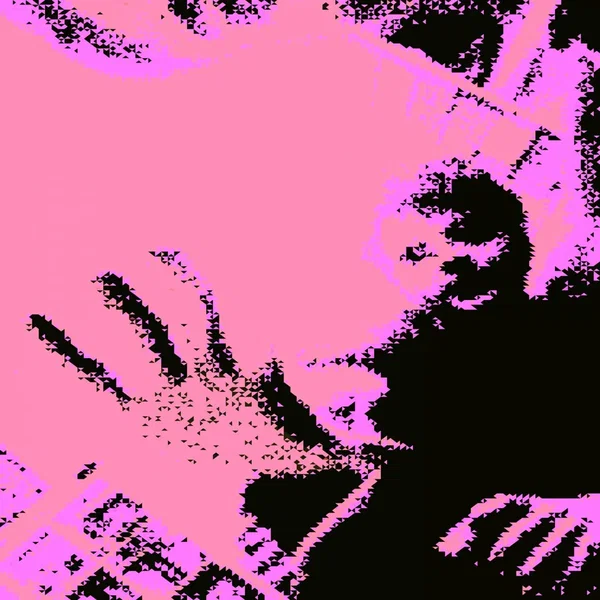 Hangnail