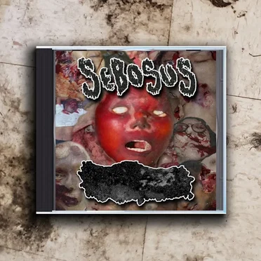 Sebosus