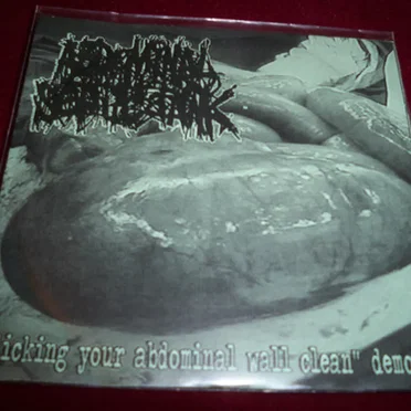 Licking Your Abdominal Wall Clean