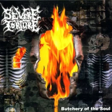 Severe Torture