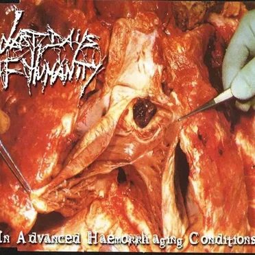 In Advanced Haemorrhaging Conditions