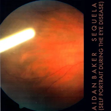 Sequela (Self Portrait During the Eye Disease)