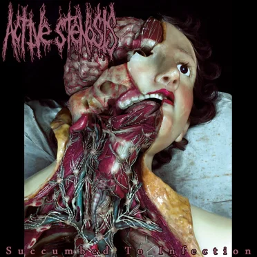 Succumbed to Infection