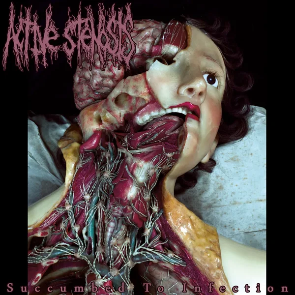 Succumbed to Infection