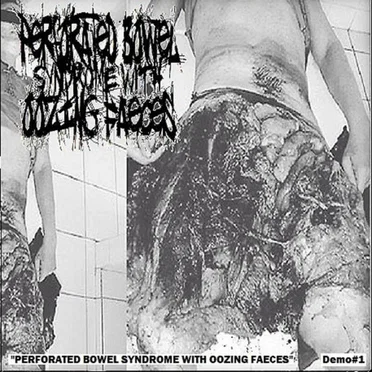 Perforated Bowel Syndrome With Oozing Faeces