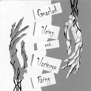 Gnarled Veins & Varicose Pains