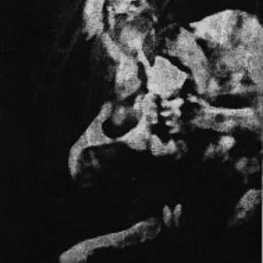 Anaal Nathrakh