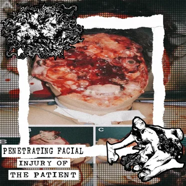 Penetrating Facial Injury of the Patient
