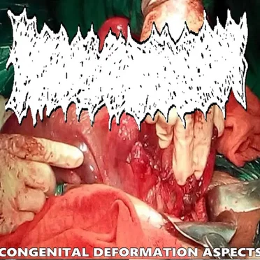 Congenital Deformation Aspects