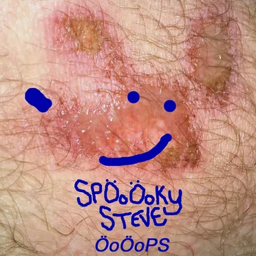 ÖoÖops