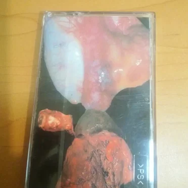 Cadaverjelly Saponification / Black Market Organ Donor