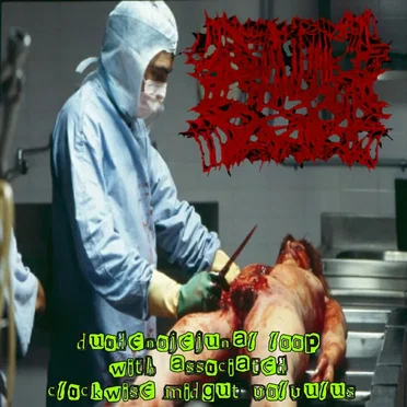 Duodenojejunal Loop With Associated Clockwise Midgut Volvulus by Blunted Torso - album cover