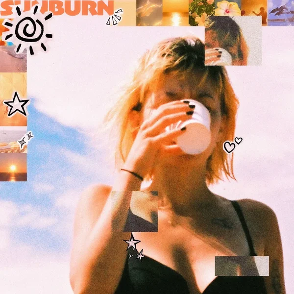 Sunburn