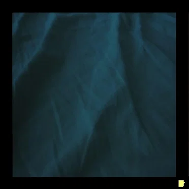 Acid EP 2