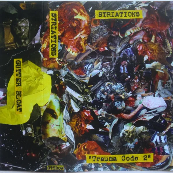 Trauma Code 2