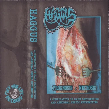 Prognosis : Necrosis