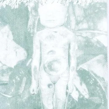 Pregnancy Rotten