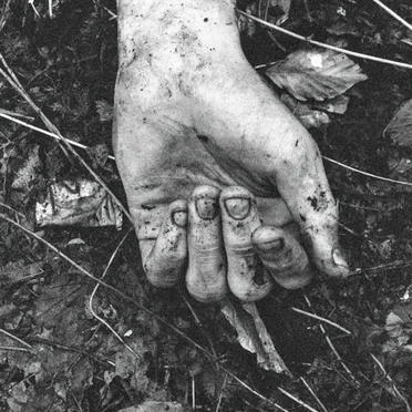 Radiated Veins
