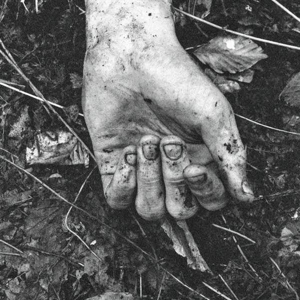Radiated Veins