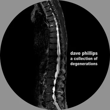 A Collection of Degenerations