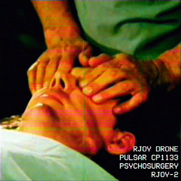 RJOY drone / pulsar CP1133 / psychosurgery / RJOY-2