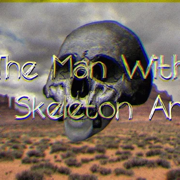 The Man With the Skeleton Arms