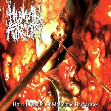 Human Atrocity