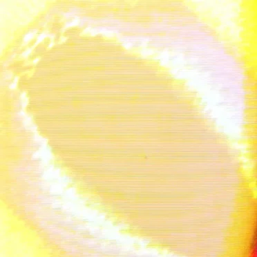 apprehension