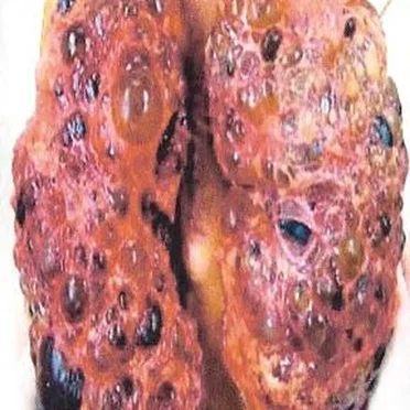 Bradymenorrhoea / Herophilus