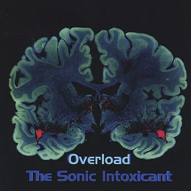 Overload: The Sonic Intoxicant by NeuroPop - album cover