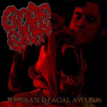 Suppurated Facial Avulsion