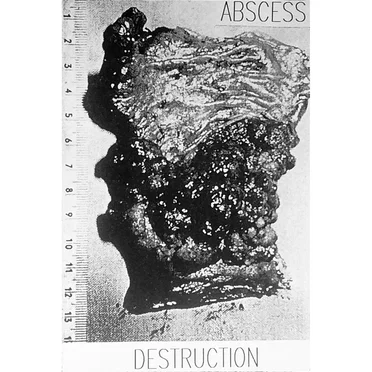 Destruction