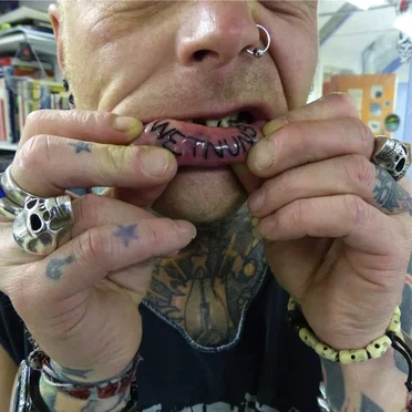 Broken Teeth