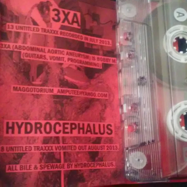 3XA / Hydrocephalus